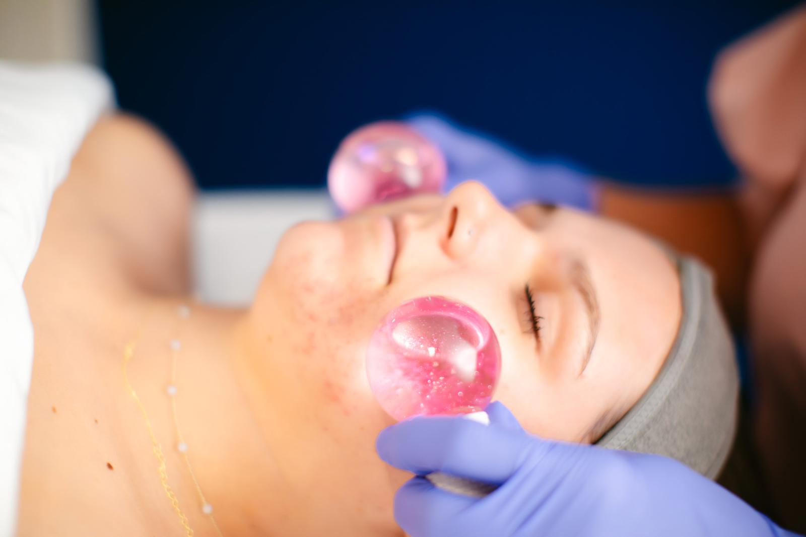 Facial using cold globes to calm the skin